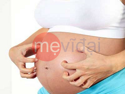 Cảnh báo nguy hiểm chứng dị ứng khi mang thai mẹ bầu cần lưu ý