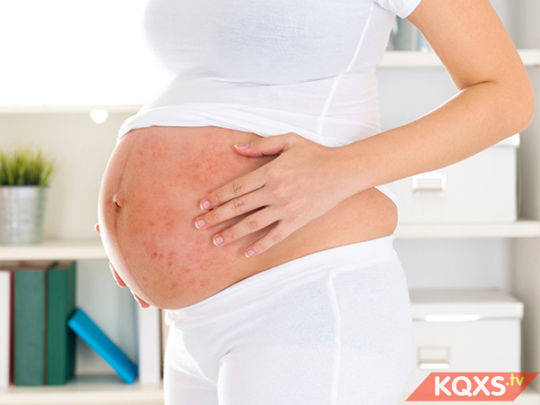 Dị ứng khi mang thai: Nguyên nhân, triệu chứng & cách điều trị nhanh khỏi