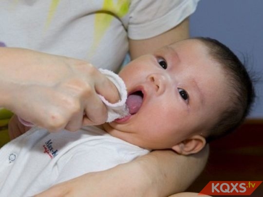 Tưa lưỡi ở trẻ sơ sinh: Nguyên nhân & cách chữa trị tại nhà hiệu quả tốt nhất